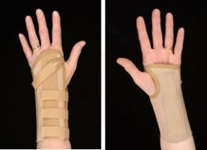 Carpal Tunnel Syndrome Msk Patient Portal Nhs Ayrshire Arran